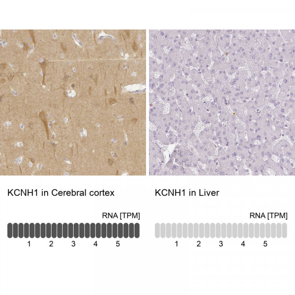 Anti-KCNH1