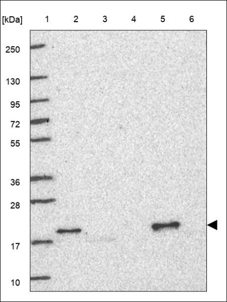 Anti-FAM3A