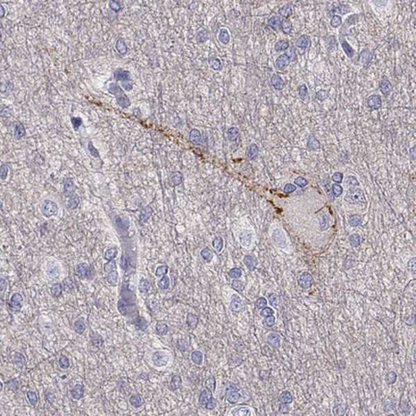 Anti-NCAM2
