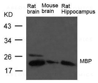 Anti-MBP(myelin basic protein)