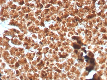Anti-Glycoprotein 2 / GP2 / ZAP75, clone GP2/3134R