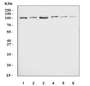 Anti-DNMT3B