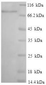 Interferon-induced protein with tetratricopeptide repeats 3 (IFIT3), human, recombinant