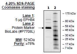 EphB4, active human recombinant protein
