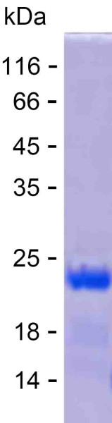 Recombinant Human ADAT3 Protein