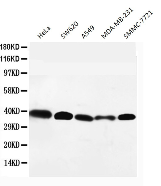 Anti-GPR2 / CCR10