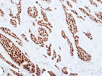 Anti-ER-alpha (human), Rabbit Monoclonal (RM494)