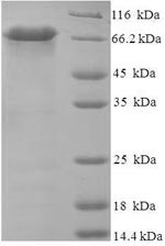 Probable serine carboxypeptidase CPVL (CPVL), human, recombinant