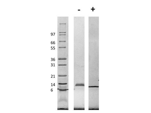 Macrophage Inflammatory Protein-1 alpha (CCL3)