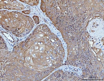 Anti-14-3-3 epsilon / YWHAE, clone 3G11G2