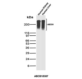 Anti-P Glycoprotein / MDR1 / ABCB1, clone ABCB1/9307