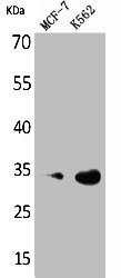 Anti-CDK4