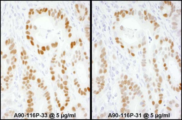 Anti-Mouse IgG-heavy and light chain, HRP conjugated