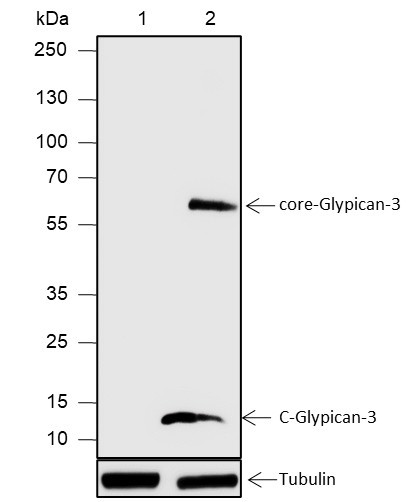 Anti-Recombinant Glypican-3, clone A577