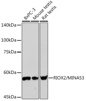 Anti-RIOX2/MINA53