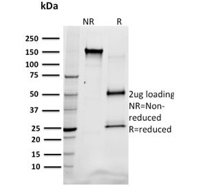 Anti-SREBP1, clone SREBP1/1578