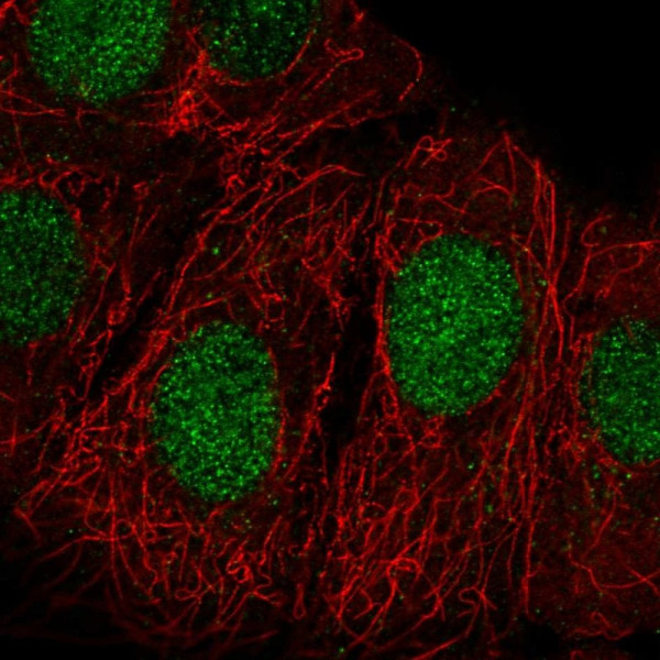 Anti-ZRANB3