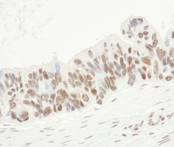 Anti-FUS (IHC)