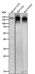 Anti-Ceruloplasmin / CP, clone 31C62