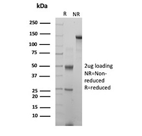 Anti-FOLR1 / Folate receptor 1, clone rFOLR1/13324