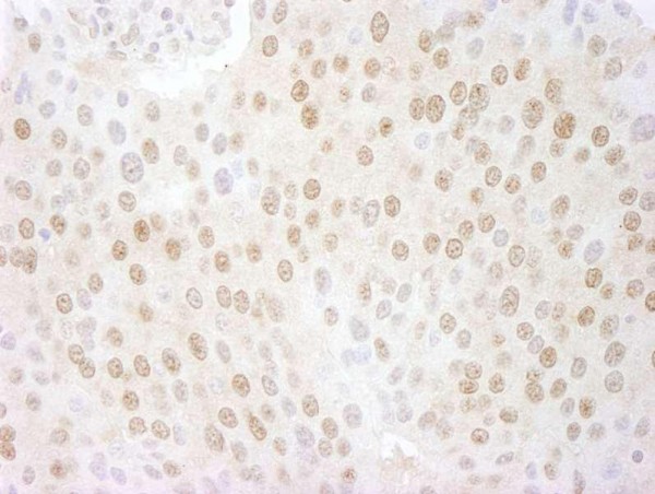 Anti-CSN5 (IHC)