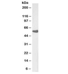 Anti-Thromboxane A2 Receptor (beta isoform)
