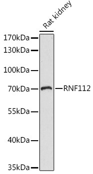 Anti-RNF112