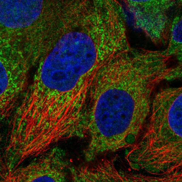Anti-CDK5RAP1