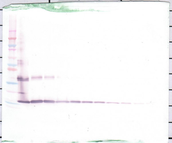 Anti-IL36 gamma