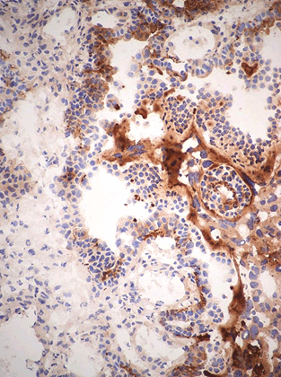 Anti-C3b/iC3b/C3c, Mouse, mAb 2/11