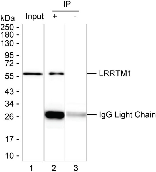 Anti-LRRTM1