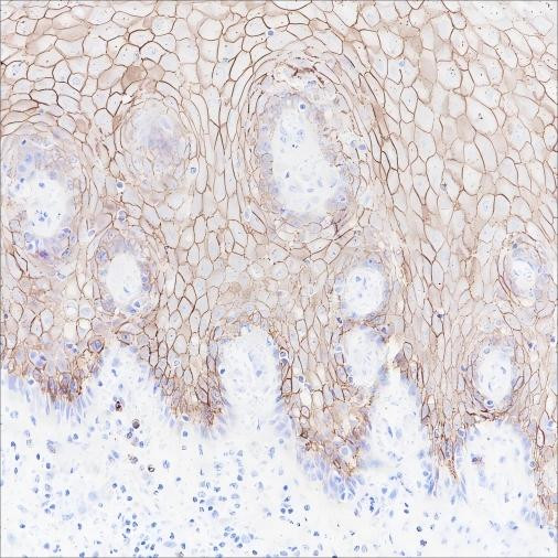 Anti-Recombinant CD138/Syndecan-1, clone A158