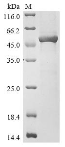 Alpha-1,3-mannosyl-glycoprotein 4-beta-N-acetylglucosaminyltransferase A (MGAT4A), partial, human, r