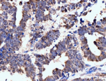 Anti-Neurofibromin Antibody / NF1