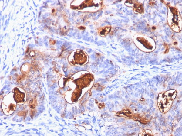 Anti-Carcinoembryonic Antigen (CEA) / CD66, clone C66/1260