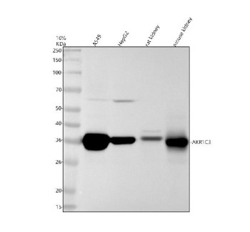 Anti-AKR1C3 / Aldo-keto reductase family 1 member C3, clone 21A20