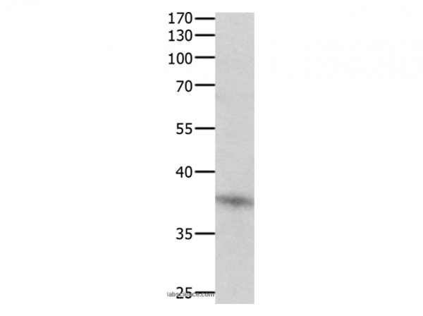 Anti-DUSP12