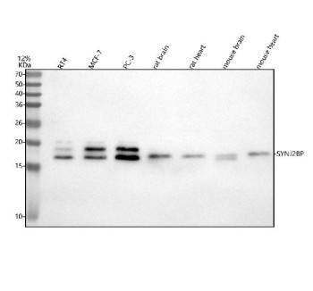 Anti-SYNJ2BP / Synaptojanin-2-binding protein