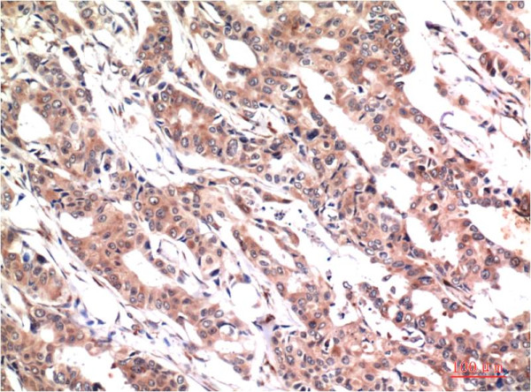 Anti-STAT3 (phospho Y705)