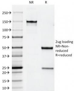 Anti-HER2 / ErbB2, clone HRB2/258