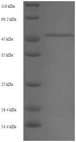 CAS1 domain-containing protein 1 (CASD1), partial, human, recombinant
