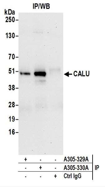 Anti-CALU