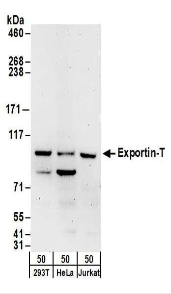 Anti-Exportin-T