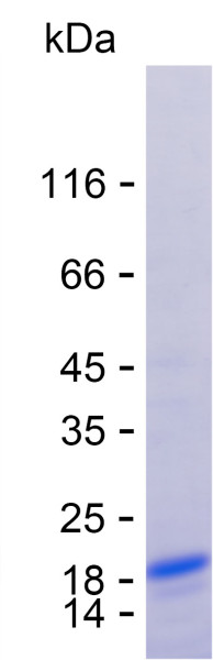 Recombinant Human PSMD13 Protein