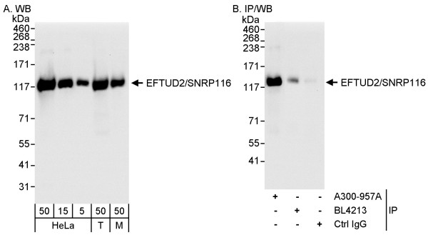 Anti-EFTUD2/SNRP116