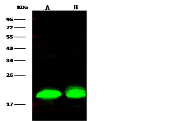 Anti-4E-BP1/EIF4EBP1 Monoclonal Recombinant Antibody