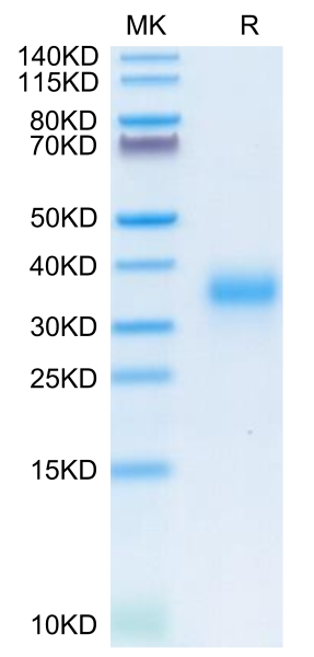 Human CD74/DHLAG Protein