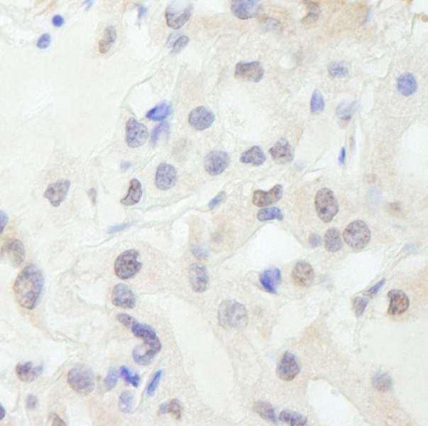 Anti-GTF3C1/TFIII220 IHC Antibody, affinity purifie (IHC)