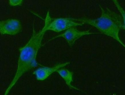 Anti-TPMT, clone 2E7