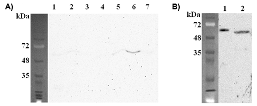 Anti-FTO (mouse), clone FT62-6